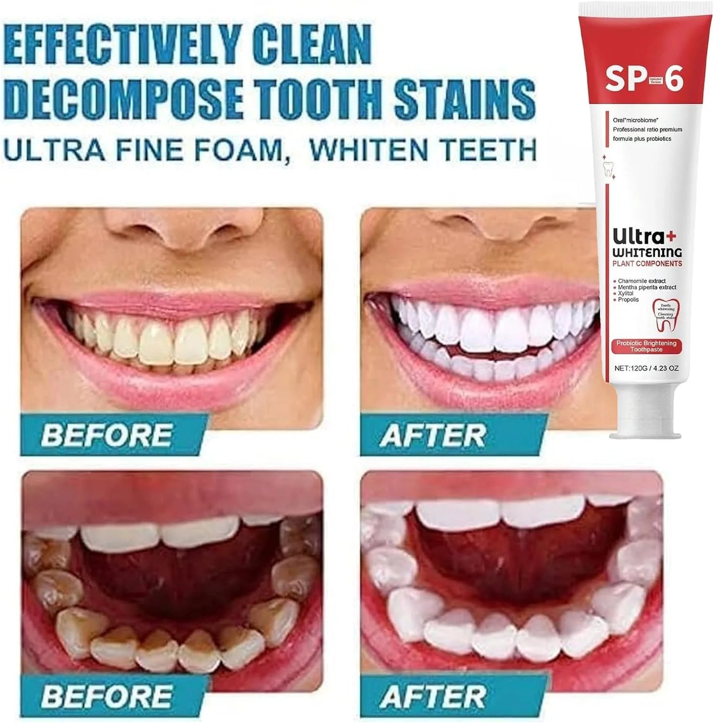 Whitening & Brightening Probiotic Tooth Paste SP-6™ - Get Rid Of Bad Breath