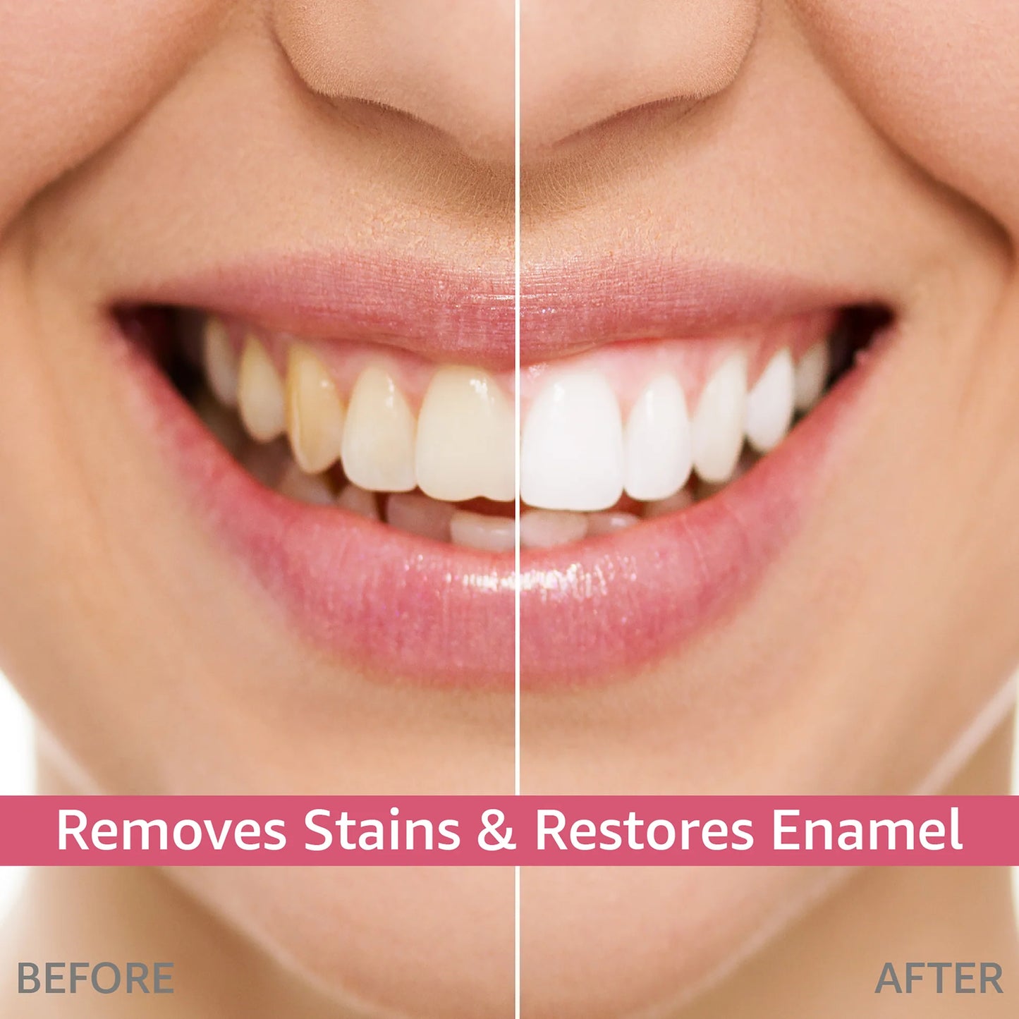 Whitening & Brightening Probiotic Tooth Paste SP-6™ - Get Rid Of Bad Breath