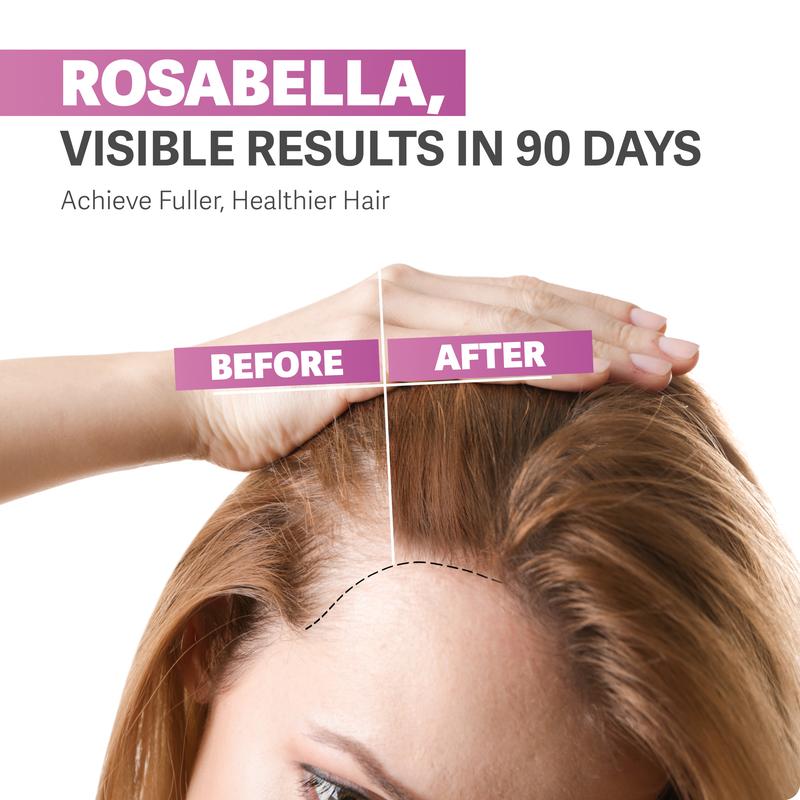 Hair, Skin, & Nails Gummies for Women & Men | #1 Advanced Formula | Fuller & Thicker Hair