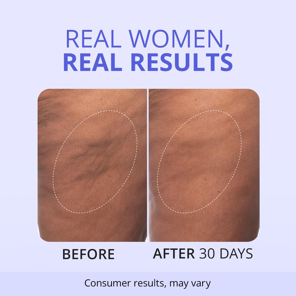 Firming Butt & Thigh Cream | #1 Selling Natural Tightening Formula