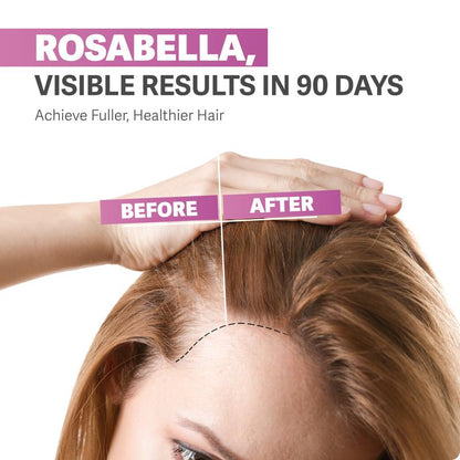 Hair, Skin, & Nails Gummies for Women & Men | #1 Advanced Formula | Fuller & Thicker Hair
